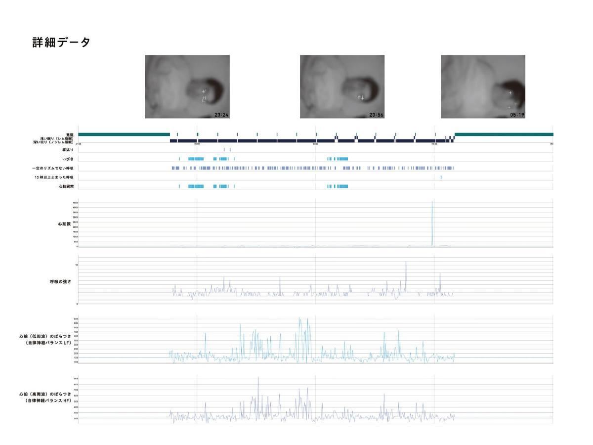 2 Capsule Rooms Male Sleep Report